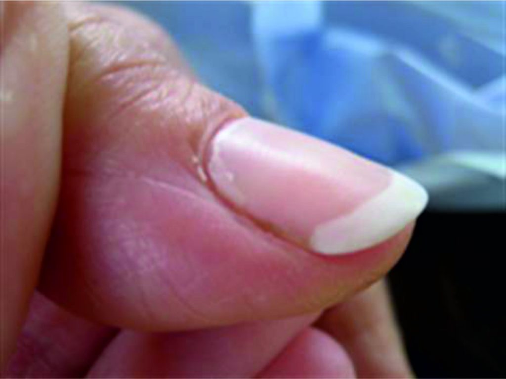 My nail just popped off! Devastating What do you do? Nail Divas